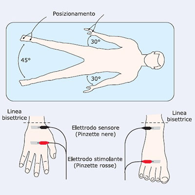 posizionamento-elettrodi-bia Posizionamento degli elettrodi per il bioimpedenziometro